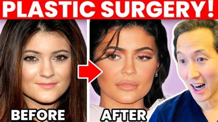 What Plastic Surgery Did Kiaraakitty Had? Before & After Photo On Reddit Of The Streamer